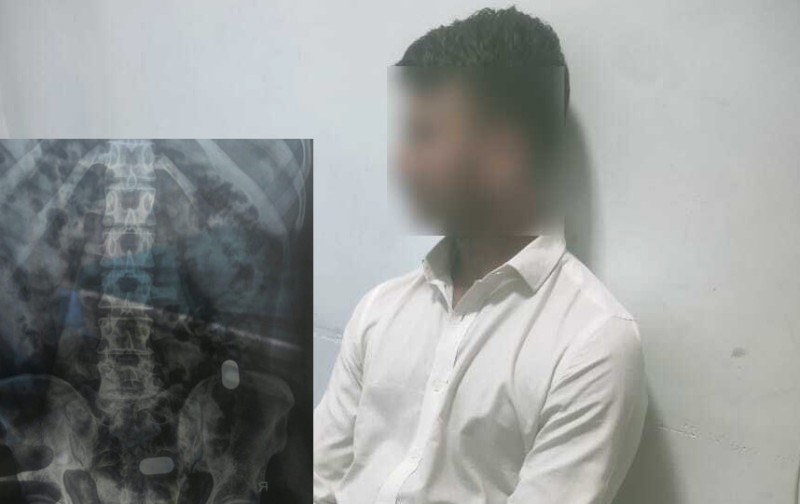 पेटभित्र लुकाएर ल्याएको सुनसहित बंगलादेशी नागरिक त्रिभुवन विमानस्थलबाट पक्राउ